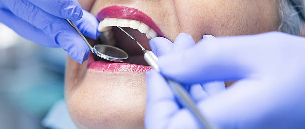 Best Emergency Tooth Extraction in Breezy Point, MN